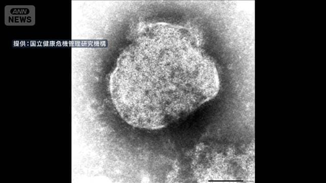 はしかの全国患者数1週間で34人　東京が22人で大半占める　今年すでに236人が感染
