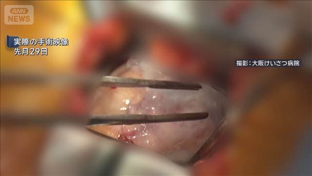 メイン記事画像